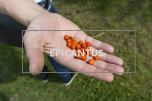 Epicantus